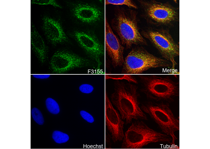 PFKM + PFKL Antibody