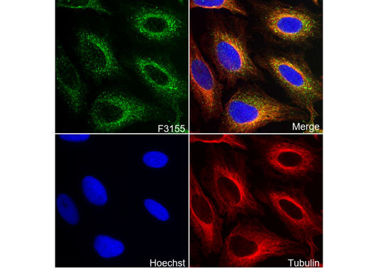 PFKM + PFKL Antibody