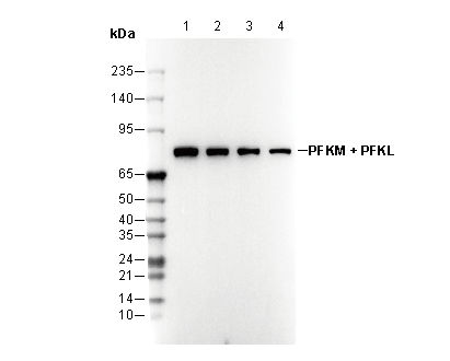 PFKM + PFKL Antibody