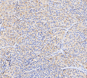 Melanoma Associated Antigen 100+ / 7 kDa Antibody
