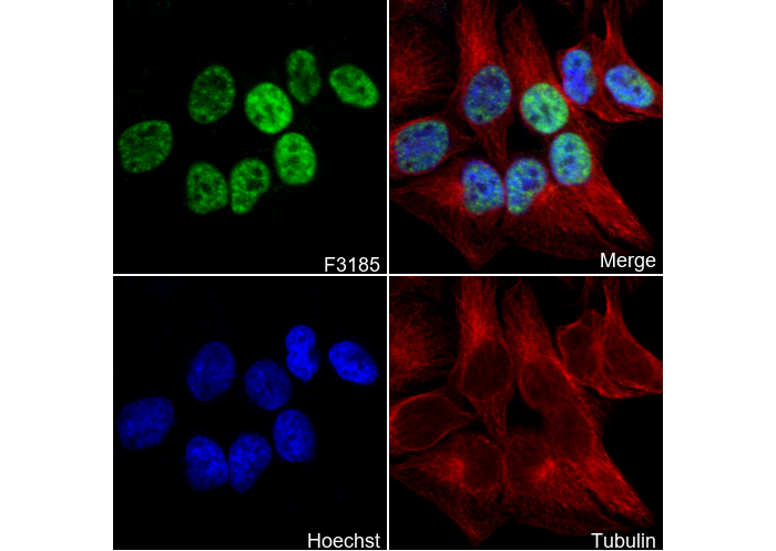 Phospho-CDK1 (T161) + CDK2/3 (T160) Antibody