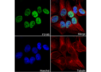 Phospho-CDK1 (T161) + CDK2/3 (T160) Antibody