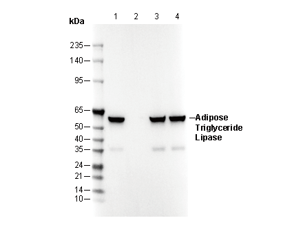 ATGL Antibody