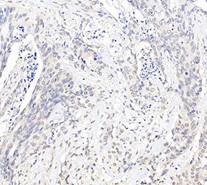 Nav1.7 Antibody