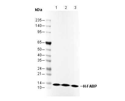 H-FABP Antibody