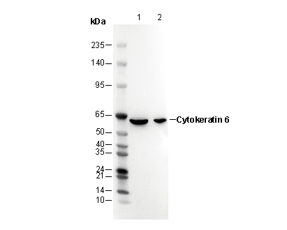 Cytokeratin 6 Antibody