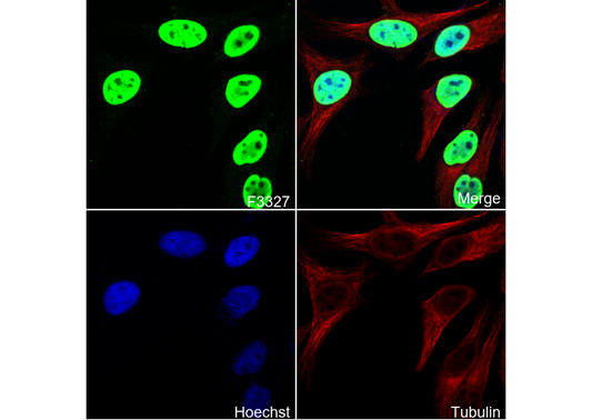 SET / TAF-I Antibody