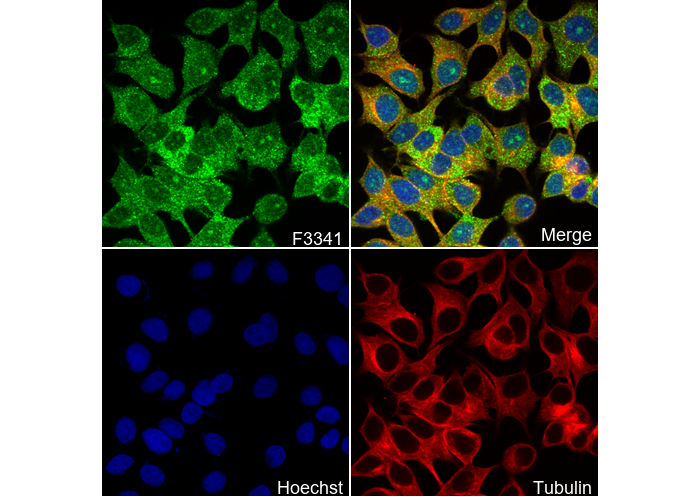 TAK1 Antibody