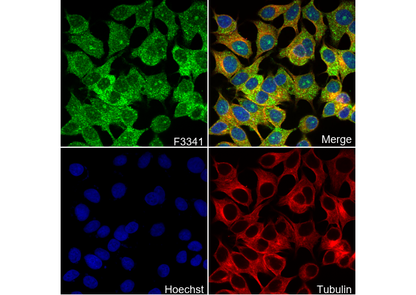 TAK1 Antibody