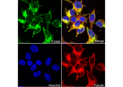 Hexokinase 1 Antibody