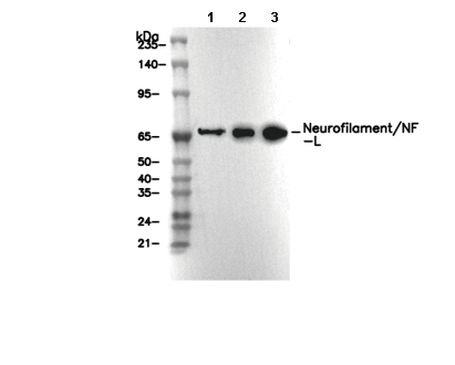 Neurofilament/NF-L Antibody