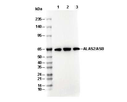ALAS2/ASB C-terminal Antibody