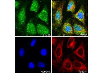MetRS/MARS Antibody
