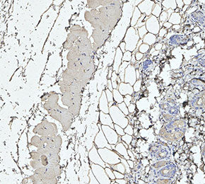 Nav1.8/SCN10A Antibody