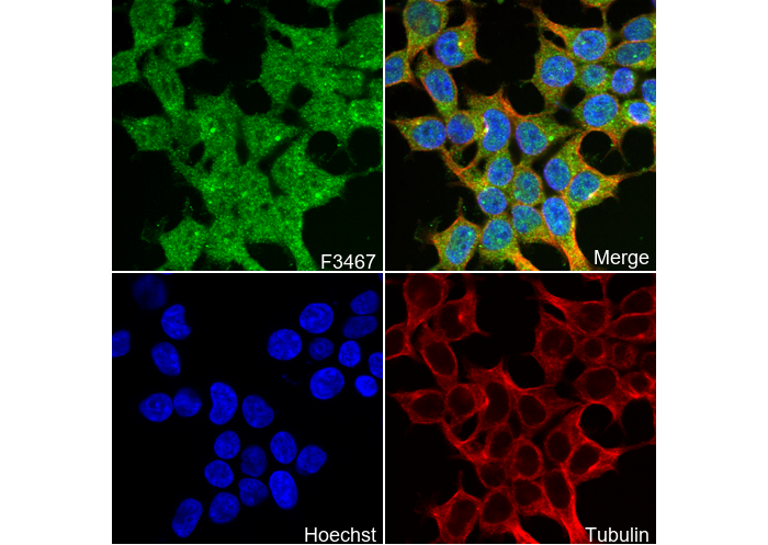 ATP6V1B1 + ATP6V1B2 Antibody