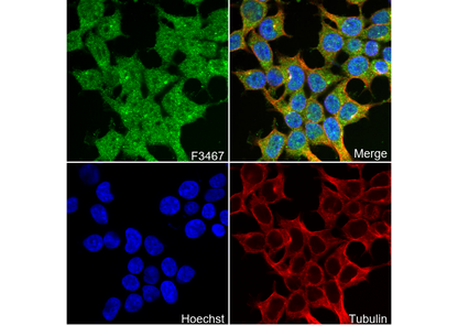 ATP6V1B1 + ATP6V1B2 Antibody