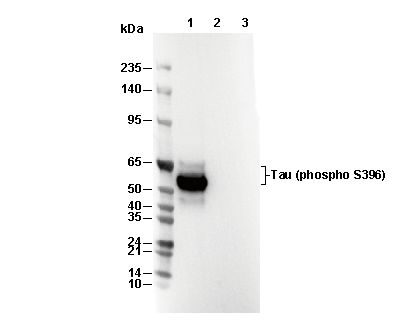 Phospho-Tau (Ser396) Antibody