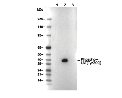 Phospho-LAT(Tyr200) Antibody