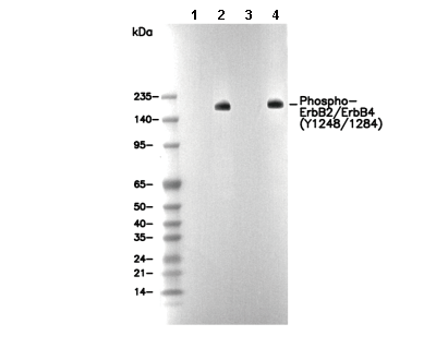 Phospho-ErbB2/ErbB4 (Y1248/1284) Antibody
