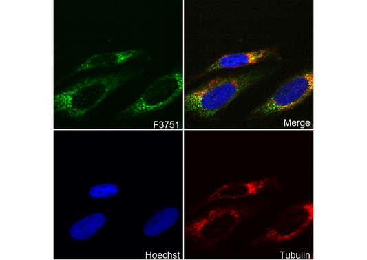 CPT1A Antibody