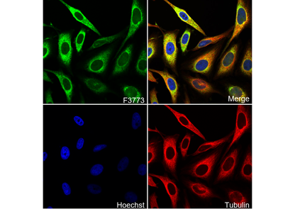 CDKN2A/p16INK4a Antibody