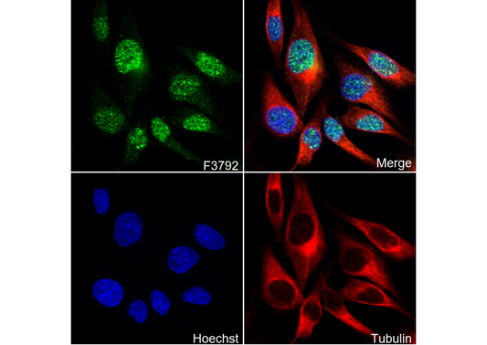 Histone H2B Antibody