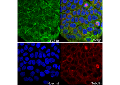 Cardiac Troponin T Antibody