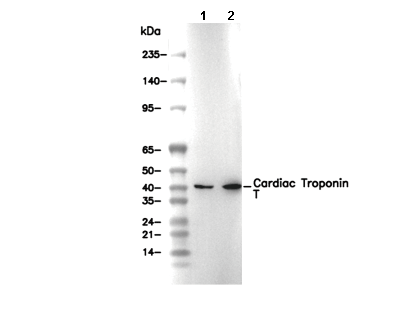 Cardiac Troponin T Antibody