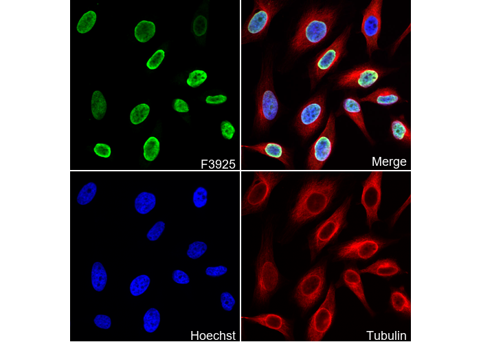 Histone H4K20me2 (di methyl Lys20) Antibody