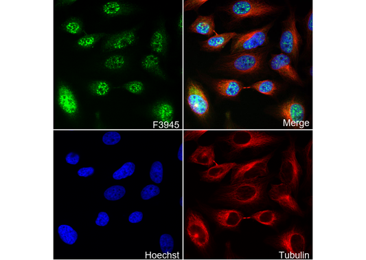 Phospho-ERK1/ERK2 (T185/Y187) Antibody