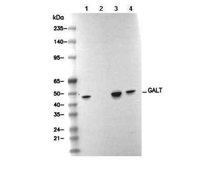 GALT Antibody