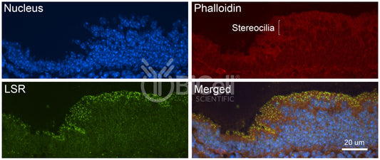 LSR (Angulin-1) Antibody - FFPE Validated