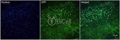 Amyloid-beta Precursor Protein (APP or AD1) Antibody