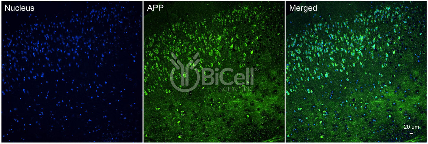 Amyloid-beta Precursor Protein (APP or AD1) Antibody - FFPE Validated