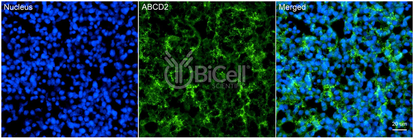 ABCD2 Antibody