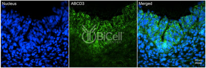 ABCD3 Antibody - Western Blot Validated