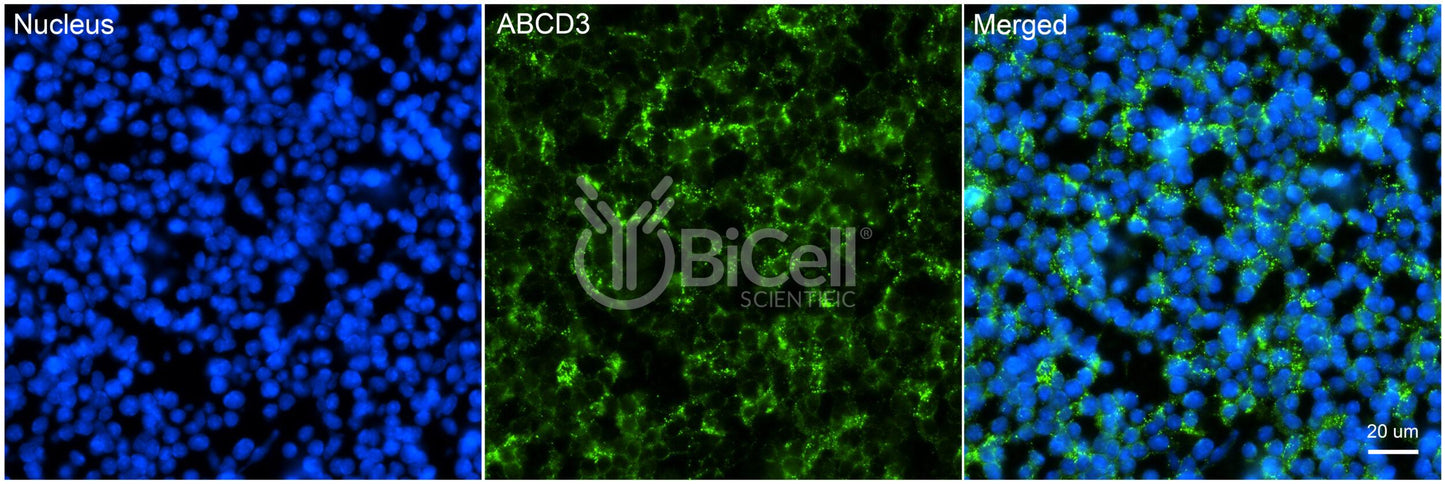 ABCD3 Antibody - Western Blot Validated