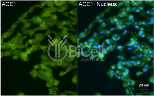 ACE1 (ACE or CD143) Antibody - FFPE Validated