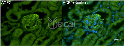 ACE2 Antibody - FFPE Validated