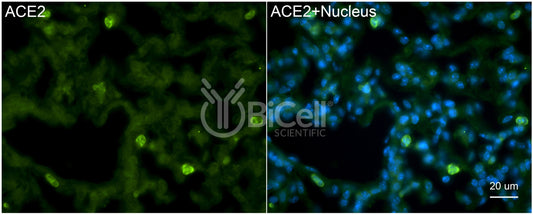 ACE2 Antibody - Western Blot Validated