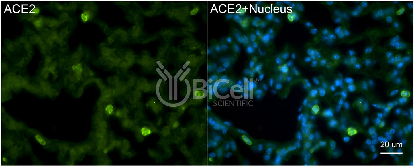 ACE2 Antibody - FFPE Validated