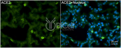 ACE2 Antibody - FFPE Validated