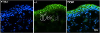 AKT (AKT1 or RAC or PKB) Antibody