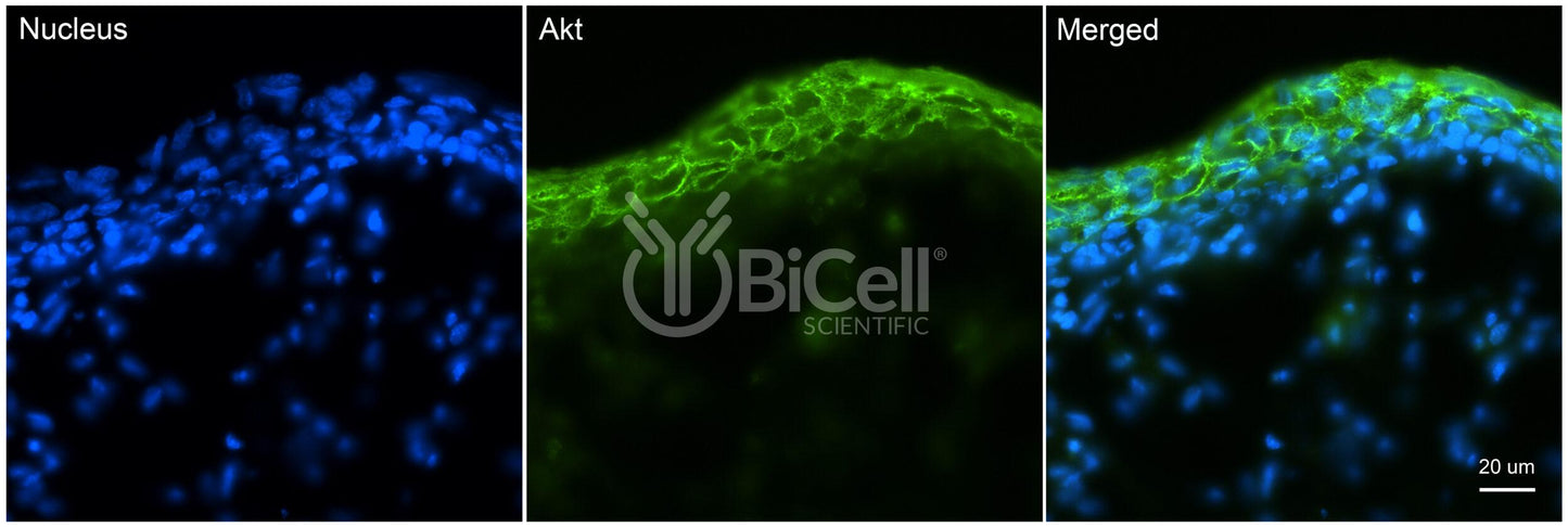 AKT (AKT1 or RAC or PKB) Antibody - FFPE Validated