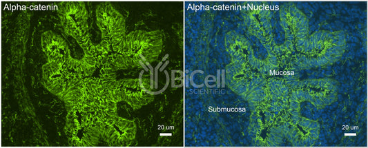 Alpha-catenin (Ctnna1) Antibody - Western Blot Validated