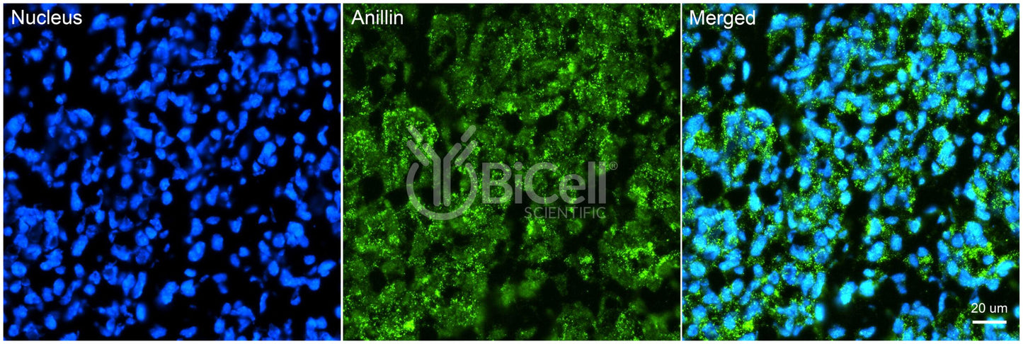 Anillin (ANLN or FSGS8) Antibody - FFPE Validated