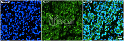 Anillin (ANLN or FSGS8) Antibody - FFPE Validated