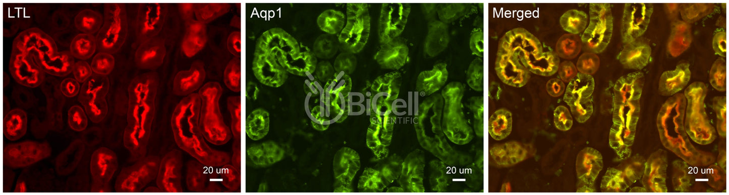 Aquaporin-1 (AQP1) Antibody