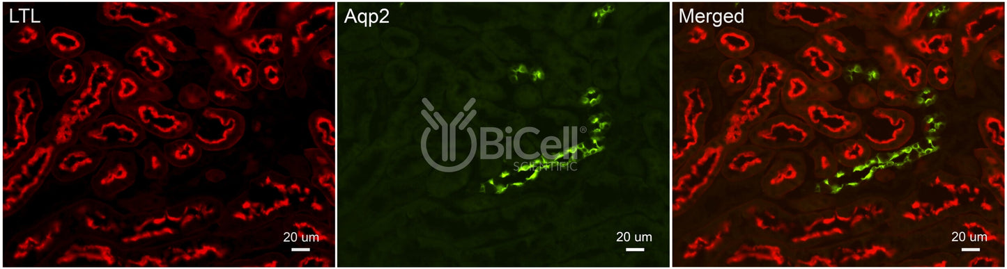 Aquaporin-2 (AQP2) Antibody