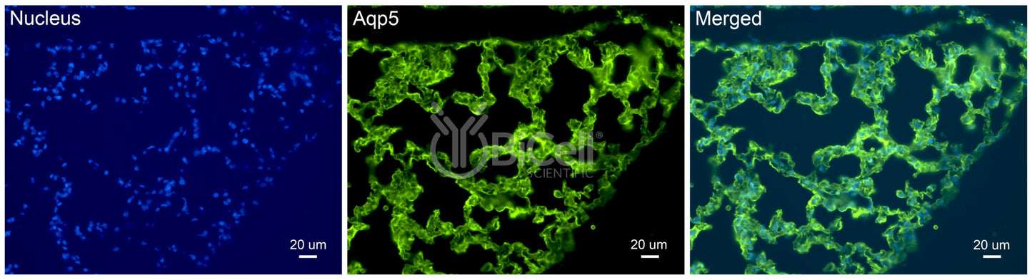 Aquaporin-5 (AQP5) Antibody - Western Blot Validated